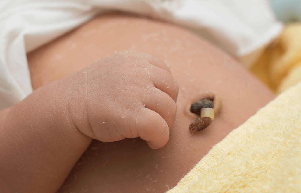 babies, baby safety, infections, umbilical cord