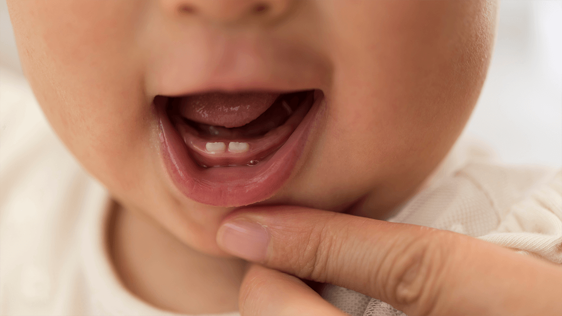 showing teeth breaking from gums in teething baby